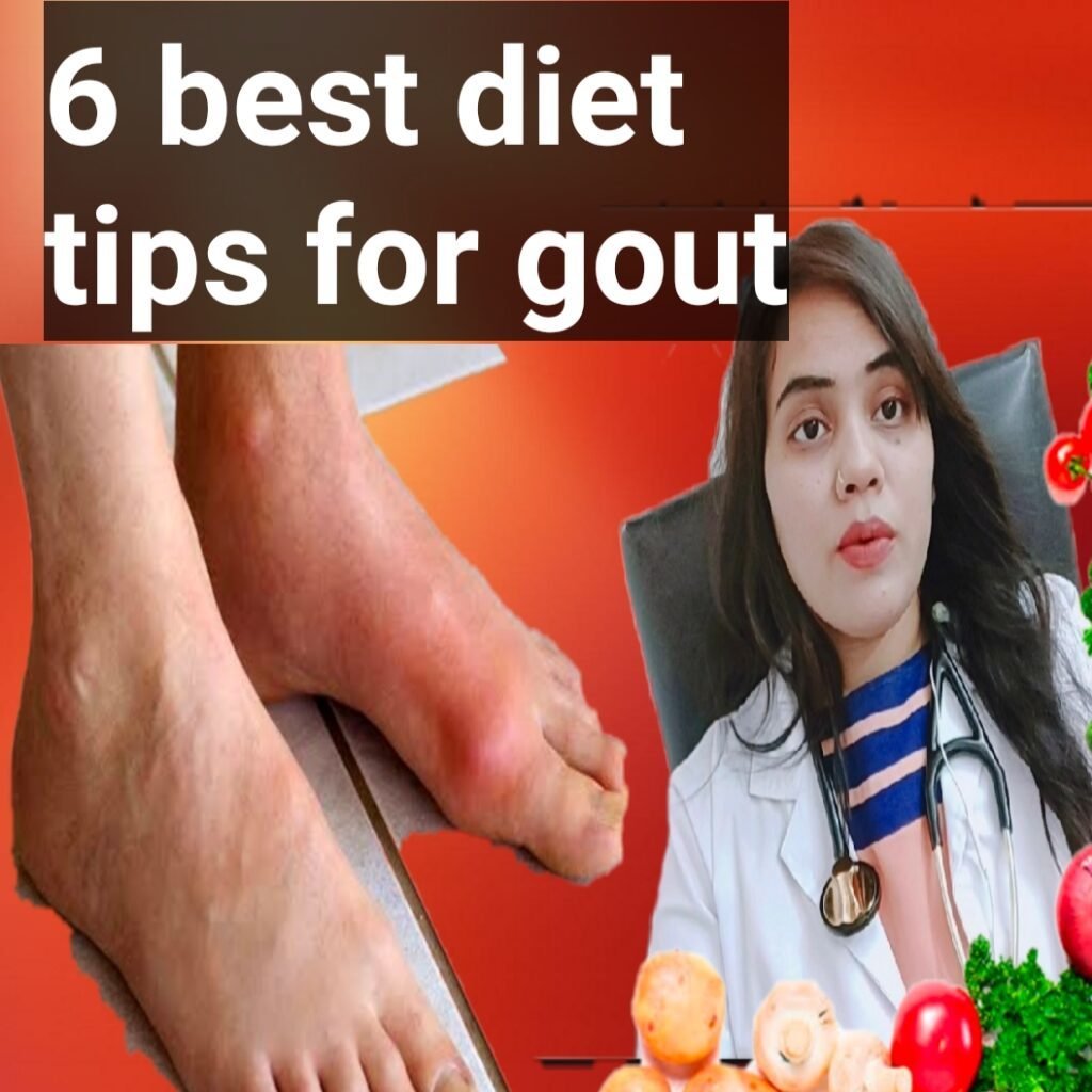 6 best diet tips for gout