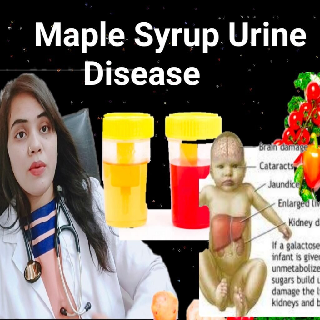 maple syrup urine disease punnett square