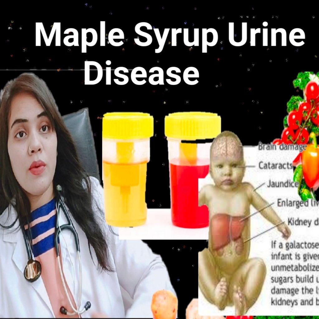 Maple Syrup Urine Disease Health And Nutrition Nutritionist Puja Ukey