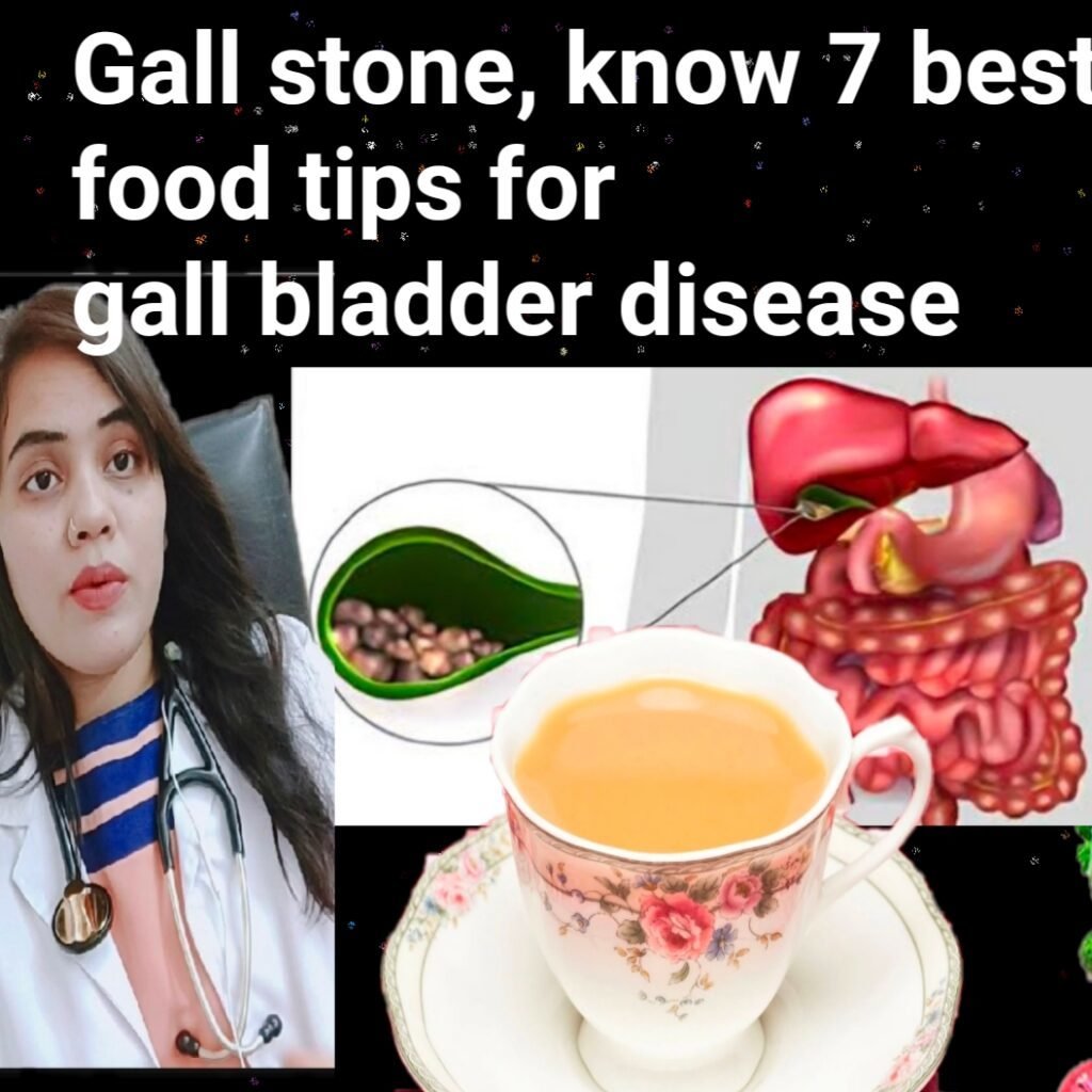 Gall stone, know 7 best food tips for gall bladder disease